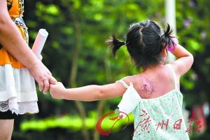 3岁女童婉婉被幼儿园老师烫伤。
